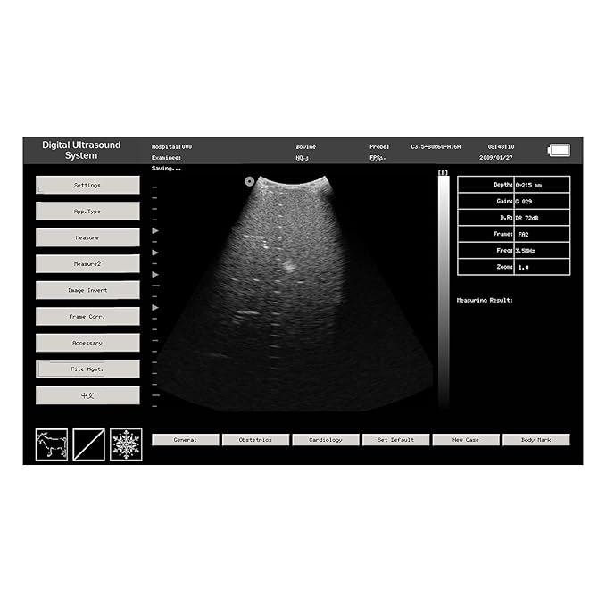 CONTEC Veterinary Portable Ultrasound Scanner For Pregnancy Check On Animals Horse Equine Goat Sheep Dog With 3.5MHz Convex Probe