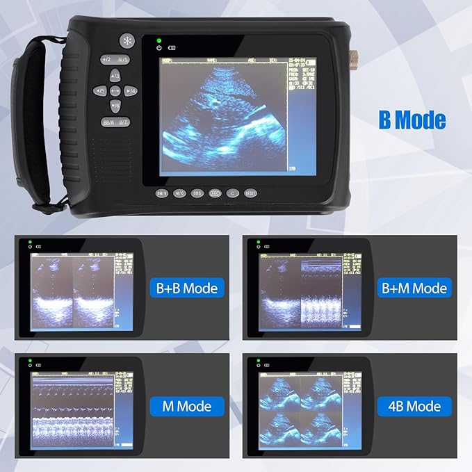 Portable Ultrasound Machine for Pregnancy - with 5.0MHz Micro-Convex Probe & 5 Imaging Modes, Pregnancy Digital Ultrasound Machine for Cattle, Horse, Pigs, Sheep, Cats, Dogs, Rabbit, Fish