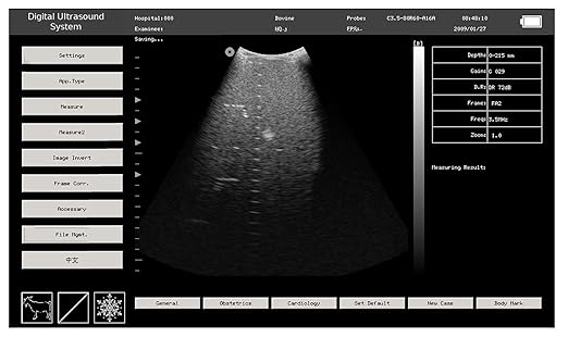 CONTEC USA Veterinary Laptop Machine Ultrasound Scanner Newest Horse/Equine/Cow/Sheep use (Convex & Rectal Linear Probe)
