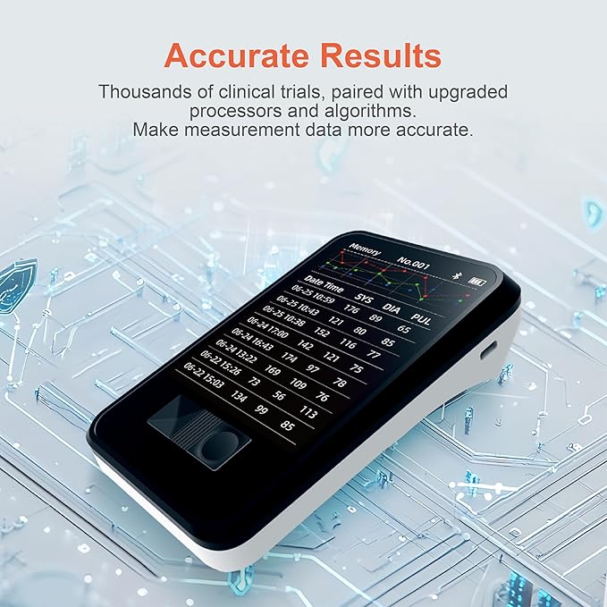 Veterinary Blood Pressure Monitor, Automatic Digital BP Machine for Dogs Cat,Silent Operation Feline Blood Pressure Monitor,3.5 inch LCD Screen and 1000 Sets Data Memory,One Button Operation